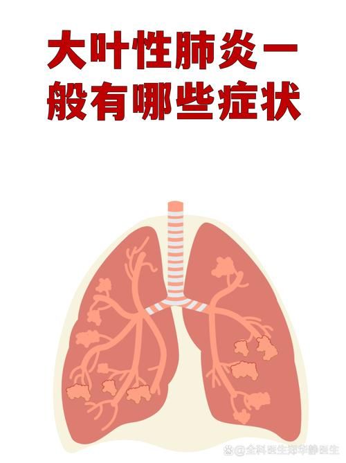  专家:重庆北碚区每年或现多个感染高峰:重庆北碚有新型肺炎吗