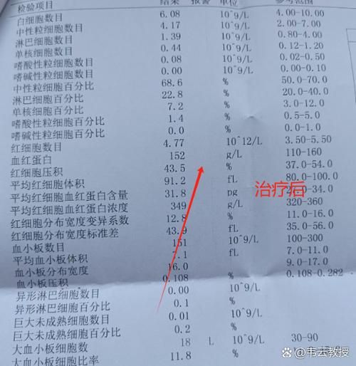 额济纳旗4月18日重症疫情数据/额济纳旗新增13例本土确诊