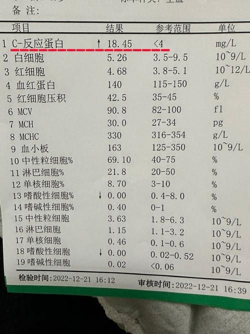  陕西咸阳杨陵区现有核酸阳性15例:陕西咸阳杨陵区现有核酸阳性15例病例