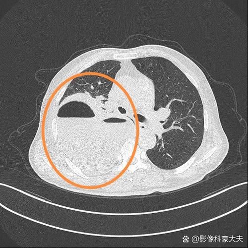 河东区近4天死亡病例活动轨迹/河东区肺炎