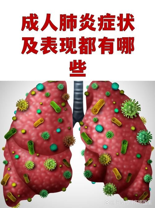 岳阳县现有重症26例/岳阳市有新型冠状病毒肺炎感染者吗