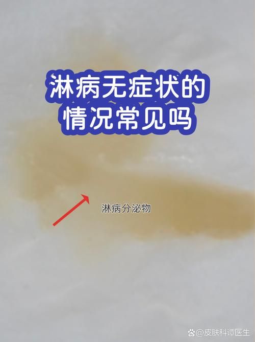 【31省市新增无症状感染者28例_全省新增无症状感染者】