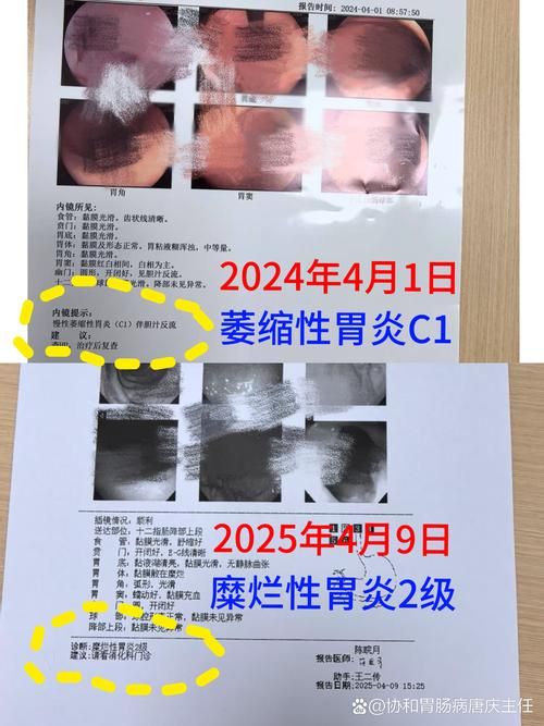 黄浦区管控区区阳性感染者详情/黄浦区确诊病例
