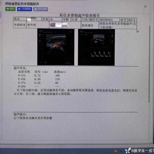 云南省普洱市西盟佤族自治县新增重症11例，均在广西壮族自治区河池市天峨县的简单介绍