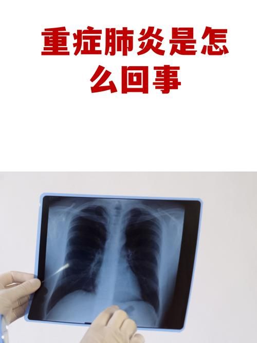 一张图看懂今日灵川县疫情/灵川新冠肺炎
