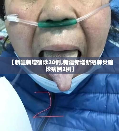 多地新增20例确诊其中本土16例/多地新增确诊病例