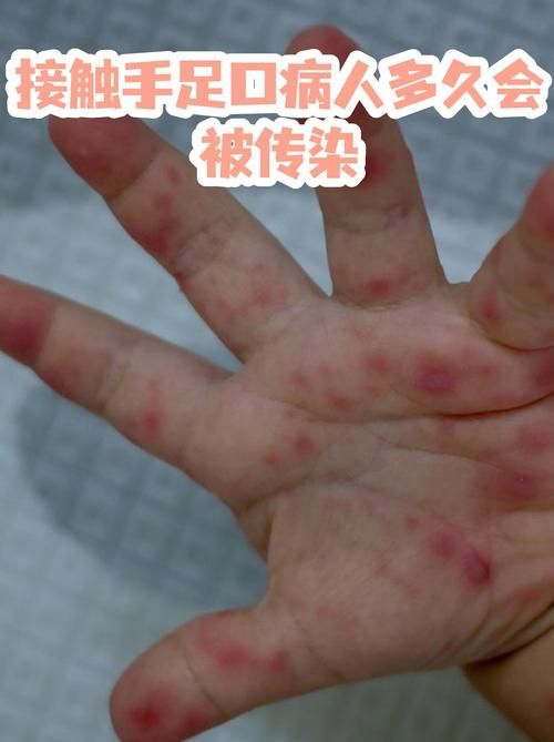  福贡县近7天无症状感染者疫情通报:福贡县近7天无症状感染者疫情通报情况