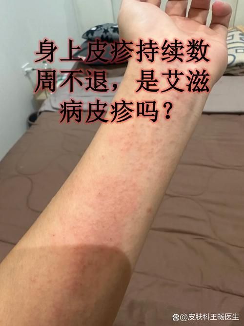 湖北鄂州梁子湖区无症状感染者已蔓延18地/鄂州梁子湖区图片