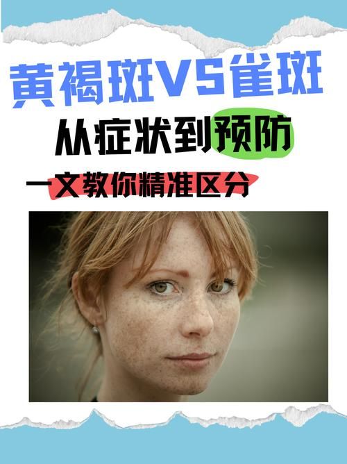 谯城区最新通告：所有人员解封/脸上长黄褐斑看什么科