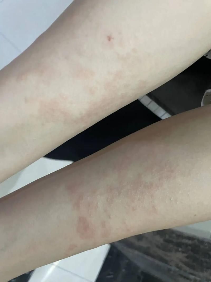 浙江绍兴诸暨疫情严重吗_诸暨今天封闭具体时间