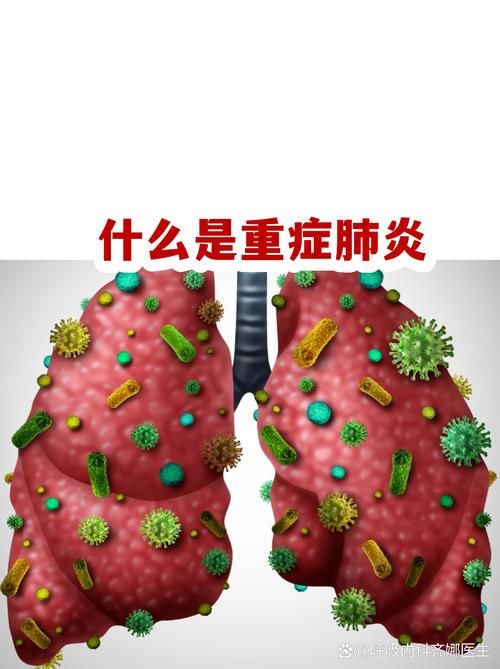 万州区通报1例重症详情(万州感染肺炎)