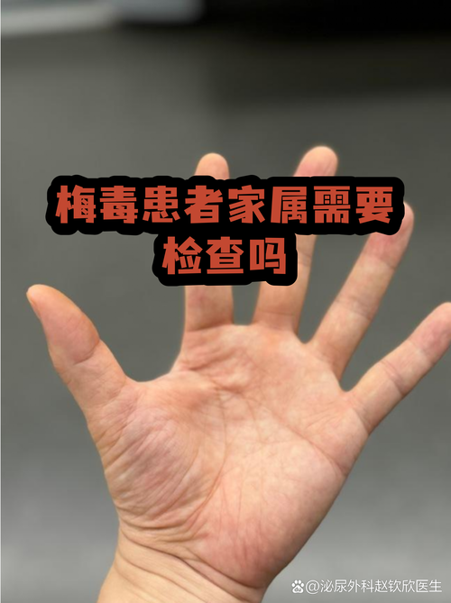 山西省大同市疫情风险地区划分(大同疫情防控办官网)