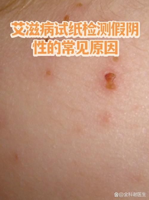 杨浦区哪里地区有疫情了呢(杨浦区艾滋病检测点)