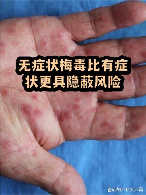 广西壮族自治区玉林市北流市静默区无症状感染者详情/广西壮族自治区玉林市北流市西垠镇新民街108号